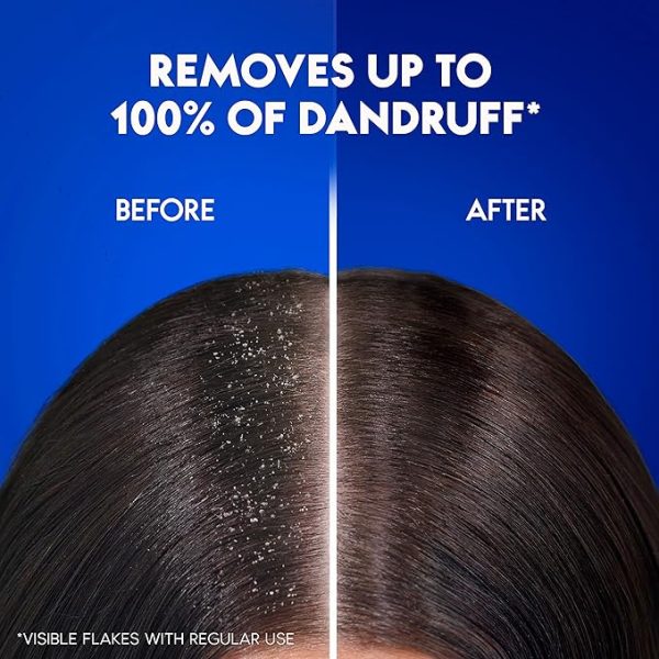 Head & Shoulders 400ml Citrus - Image 3